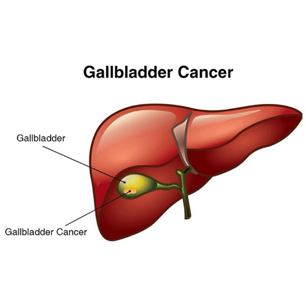 Gallbladder and Biliary Clinic - Zymus Hospital