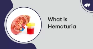 hematuria