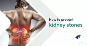 kidney stones-blog