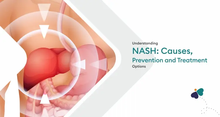 Understanding NASH: Causes, Prevention and Treatment Options