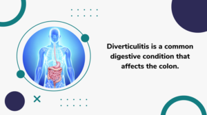 diverticulitis