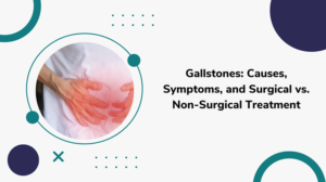 gallstones