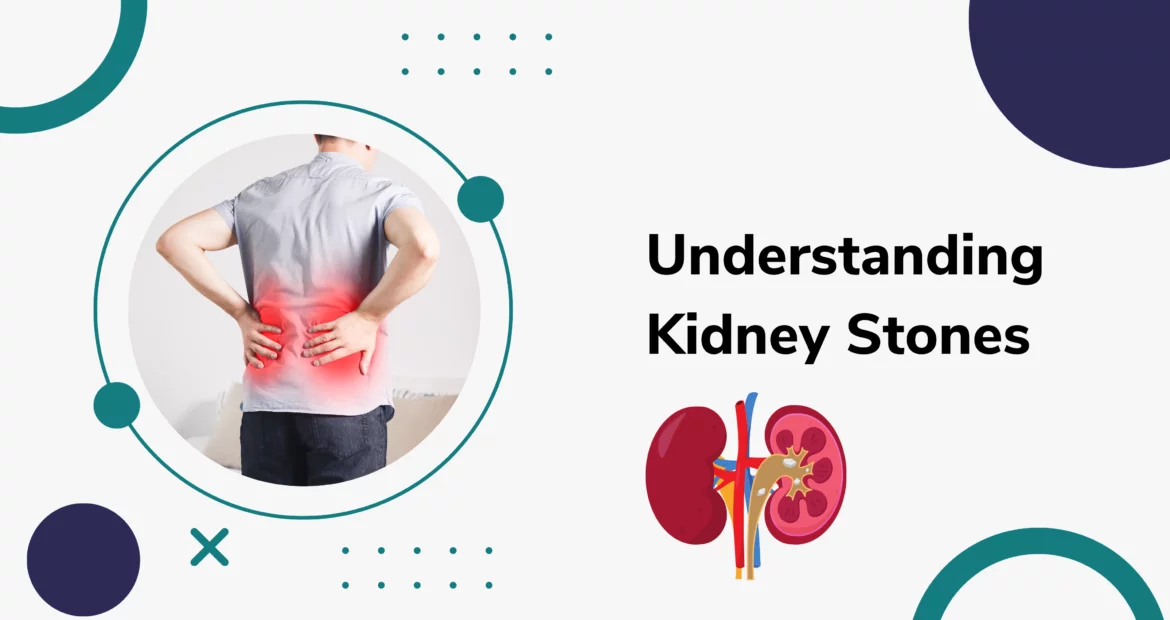 Understanding Kidney Stones Causes And Symptoms All Y vrogue.co