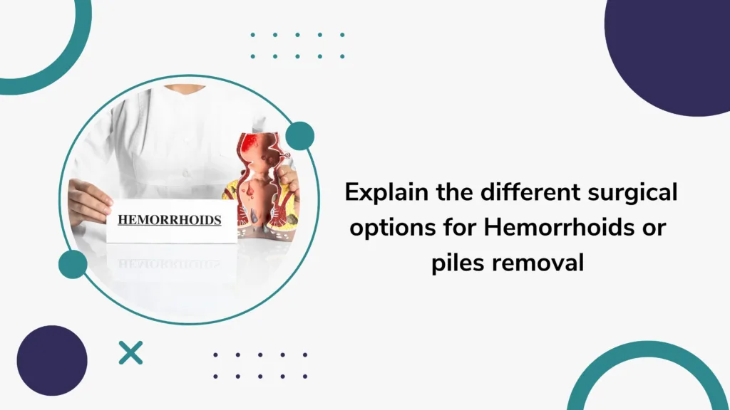 Explain the Different Surgical Options for Hemorrhoids or Piles Removal ...