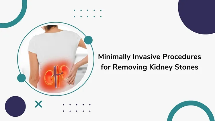 minimally invasive procedures for removing kidney stones