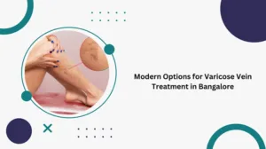 innovative solutions modern treatment options for varicose veins in bangalore
