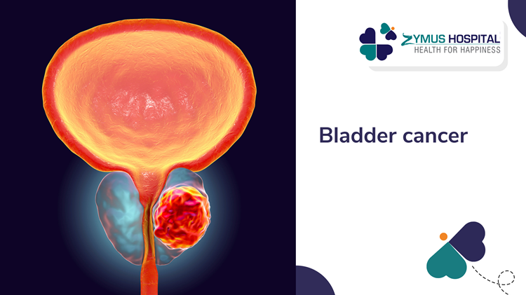 bladder cancer