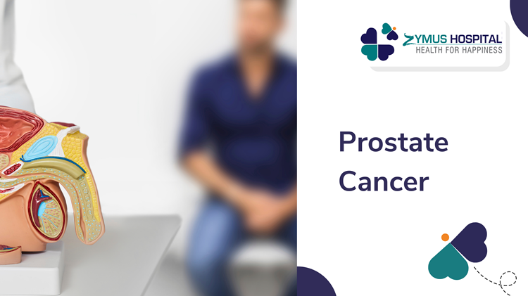 prostate cancer