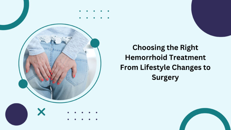 Choosing the Right Hemorrhoid Treatment From Lifestyle Changes to Surgery