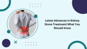 Latest Advances in Kidney Stone Treatment What You Should Know