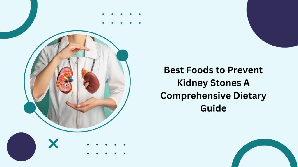 Best Foods to Prevent Kidney Stones A Comprehensive Dietary Guide ...