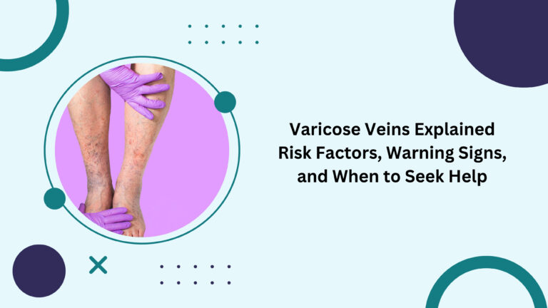 Varicose Veins Explained Risk Factors, Warning Signs, and When to Seek Help