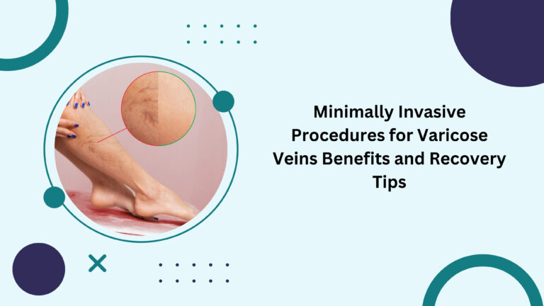 Minimally Invasive Procedures for Varicose Veins Benefits and Recovery Tips